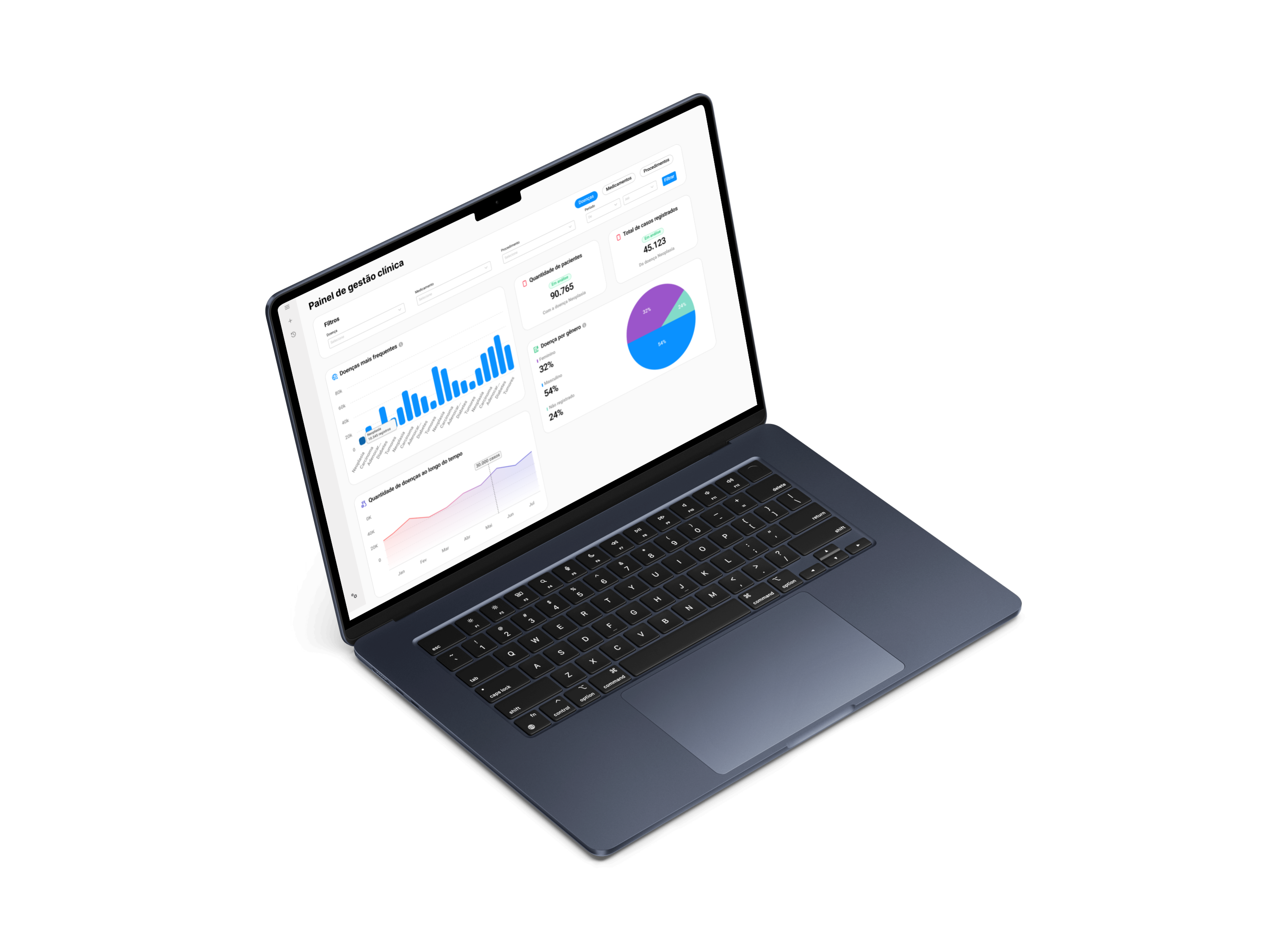 Um Macbook com o sistema anestesia conectada aberto