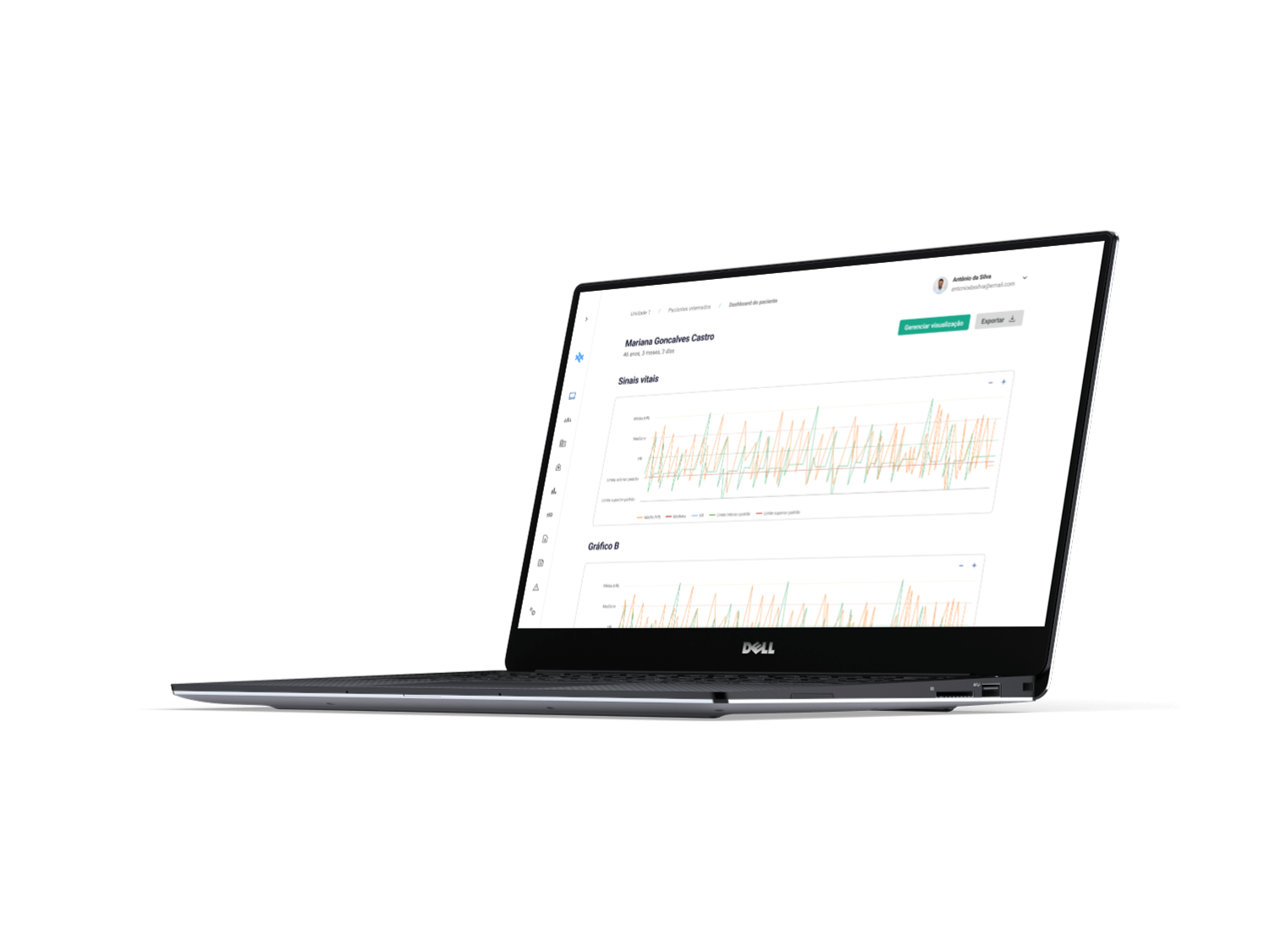 Um Macbook com o sistema anestesia conectada aberto